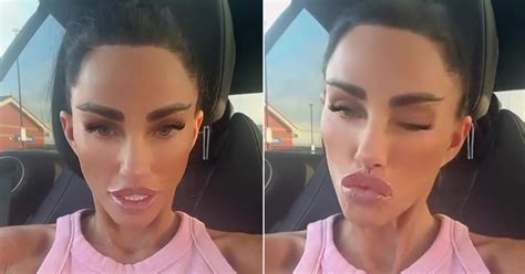 Katie Prices £10,000 facelift surprises fans in a new video